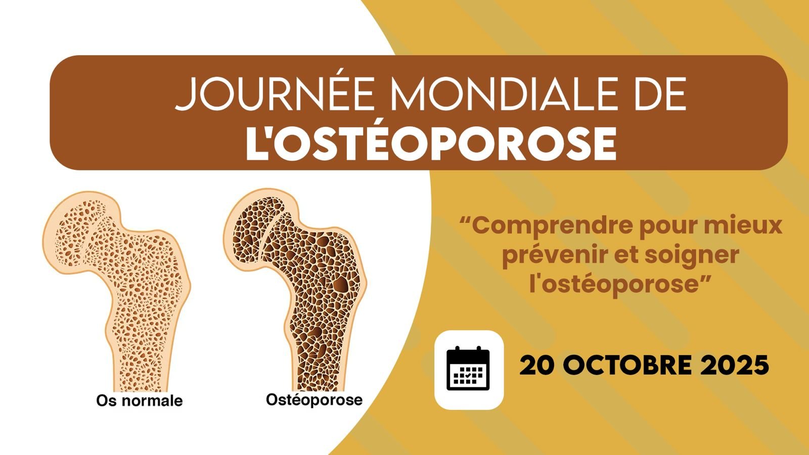 SMRh journée mondiale de l'ostéoporose